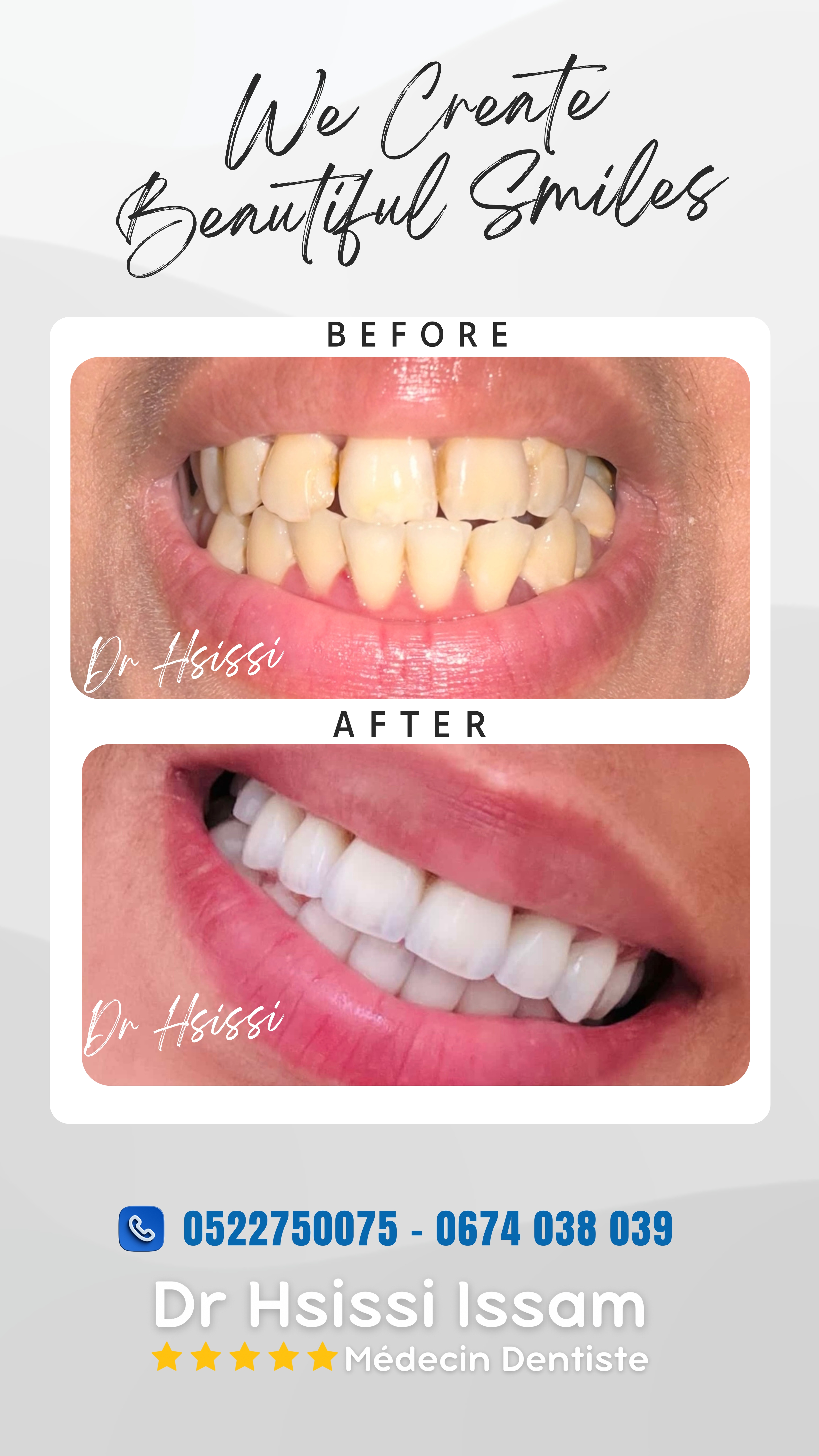 Centre Dentaire Dr Hsissi Issam - sidi El Bernoussi Casablanca - Esthétique de sourire -Soins Dentaires -Chirurgie - Couronnes et prothèse - atteintes de la gencive et du parodonte -Orthodontie - Pédodontie 