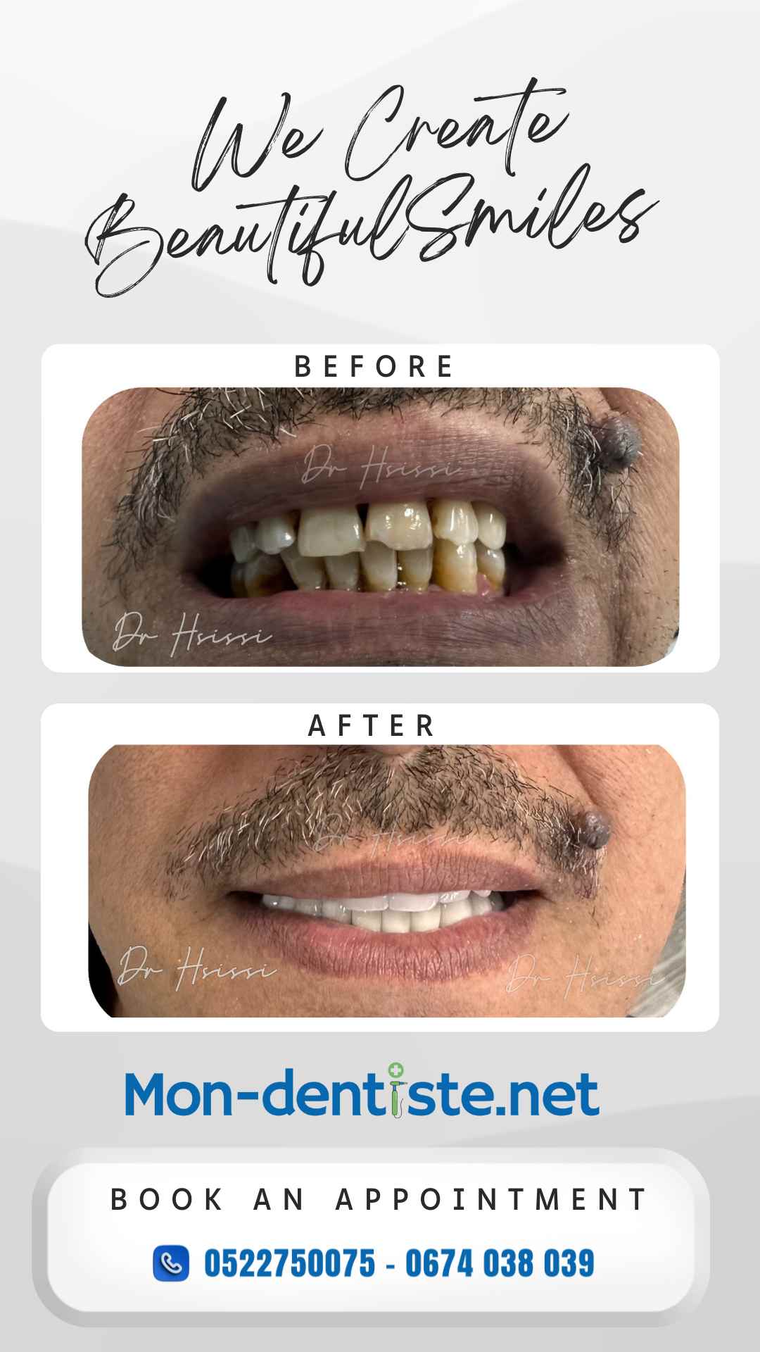 Centre Dentaire Dr Hsissi Issam - sidi El Bernoussi Casablanca - Esthétique de sourire -Soins Dentaires -Chirurgie - Couronnes et prothèse - atteintes de la gencive et du parodonte -Orthodontie - Pédodontie 