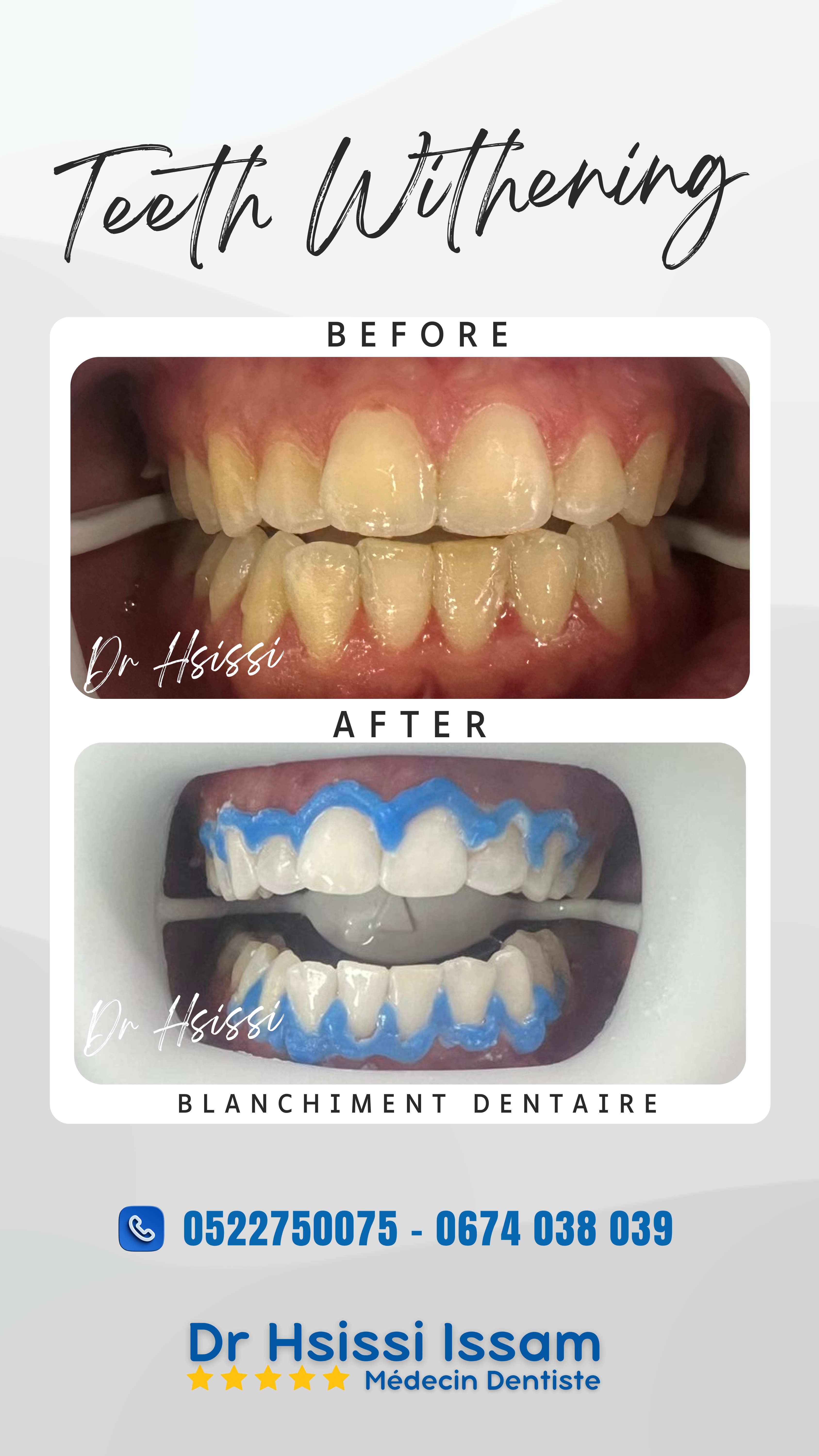 Centre Dentaire Dr Hsissi Issam - sidi El Bernoussi Casablanca - Esthétique de sourire -Soins Dentaires -Chirurgie - Couronnes et prothèse - atteintes de la gencive et du parodonte -Orthodontie - Pédodontie 