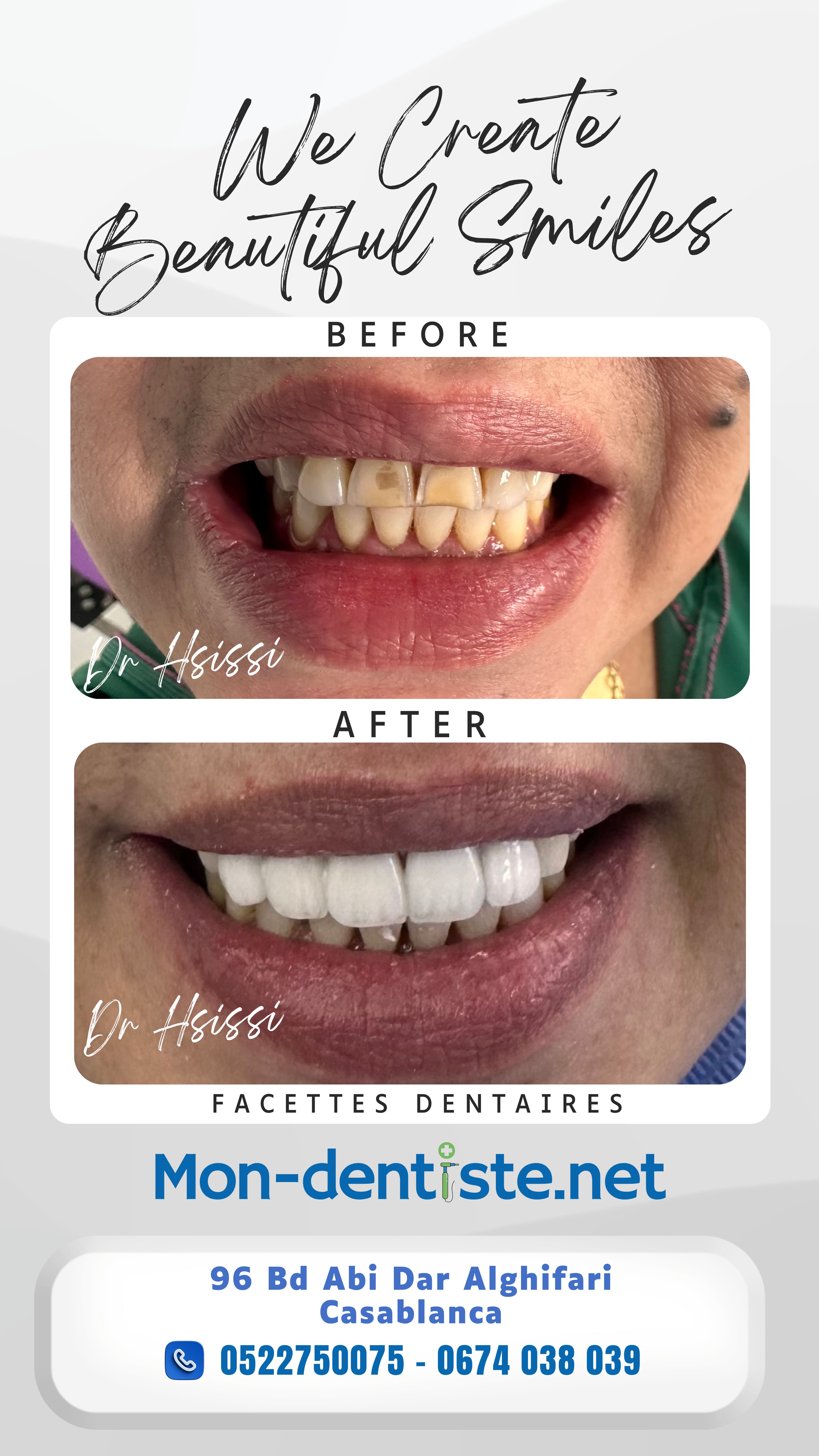 Centre Dentaire Dr Hsissi Issam - sidi El Bernoussi Casablanca - Esthétique de sourire -Soins Dentaires -Chirurgie - Couronnes et prothèse - atteintes de la gencive et du parodonte -Orthodontie - Pédodontie 